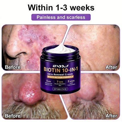 Biotin 10-in-1  Restoration Cream