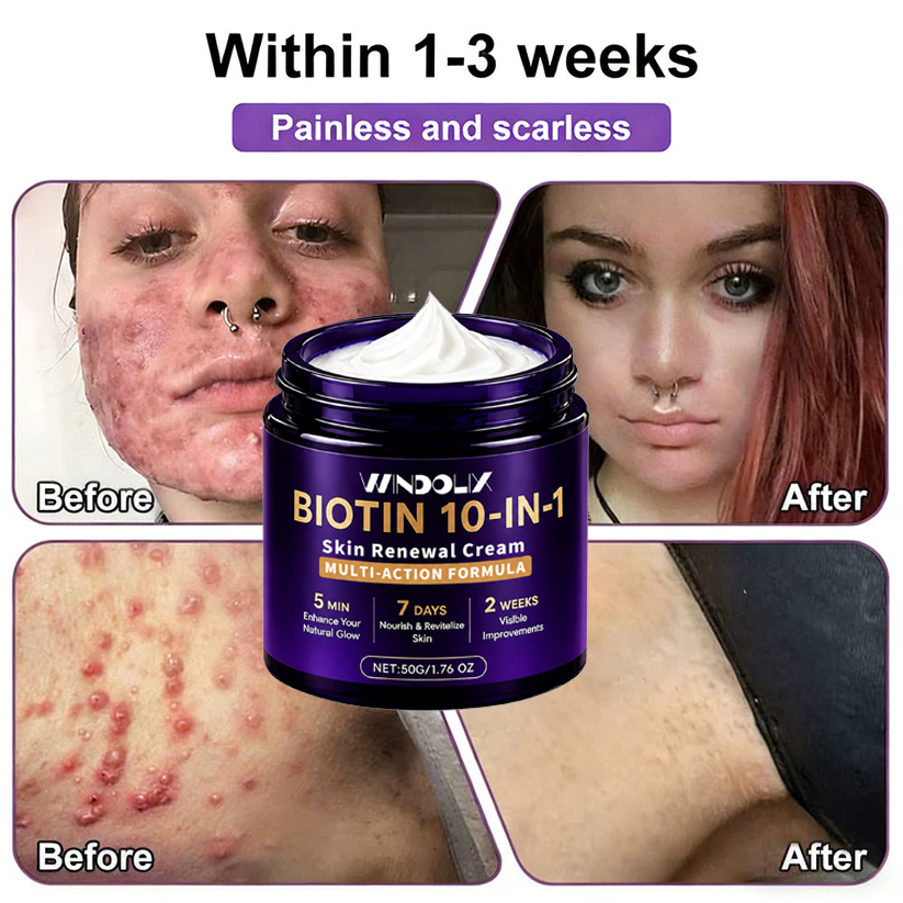 Biotin 10-in-1  Restoration Cream