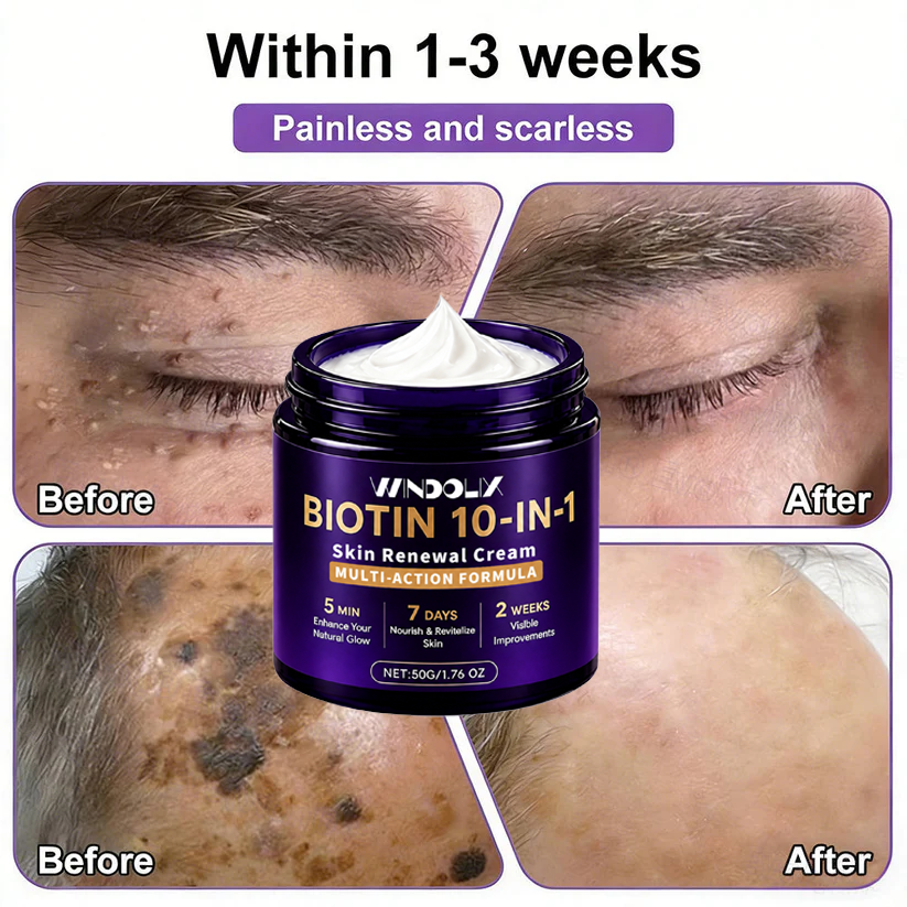 Biotin 10-in-1  Restoration Cream