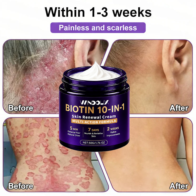 Biotin 10-in-1  Restoration Cream