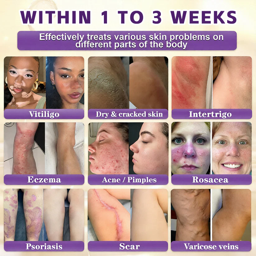 Biotin 10-in-1  Restoration Cream